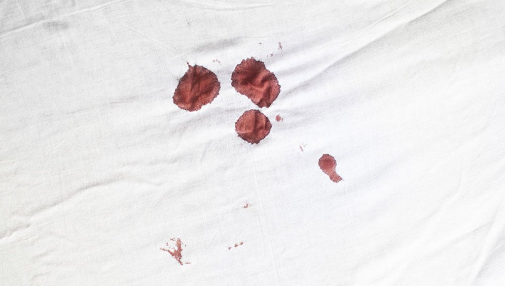 ¿Sangras la cama después de las relaciones sexuales?