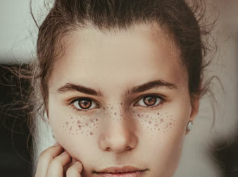 dermaplaning