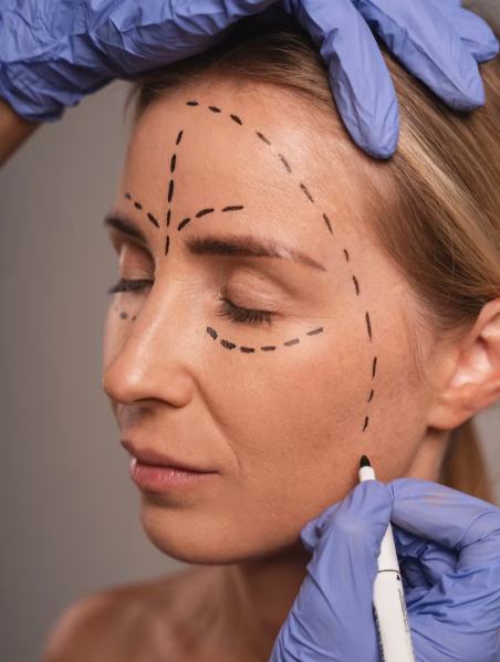 Bioestimuladores. Freepik