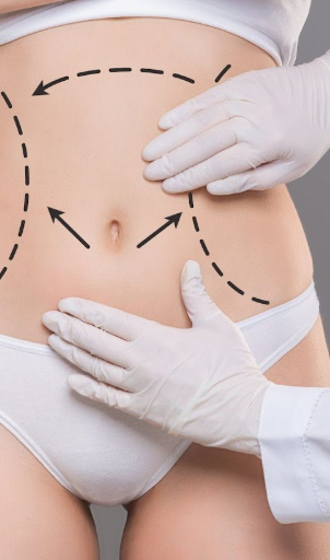 Contorno corporal sin flacidez de la piel