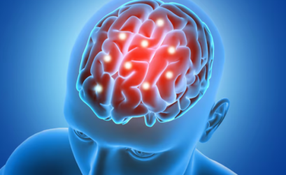 Derrame cerebral
