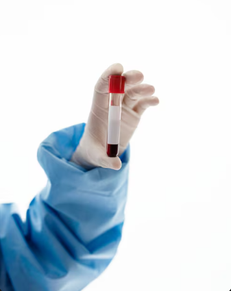 Análisis para la prevención