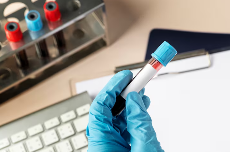 Infecciones de transmisión sexual