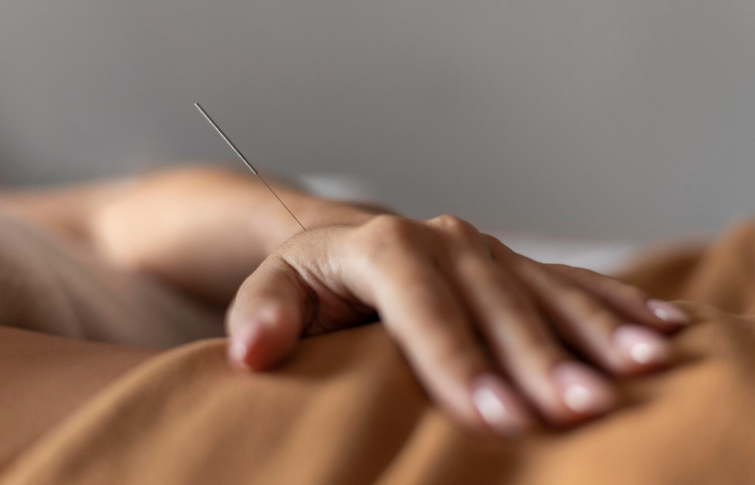 Acupuntura y fertilidad