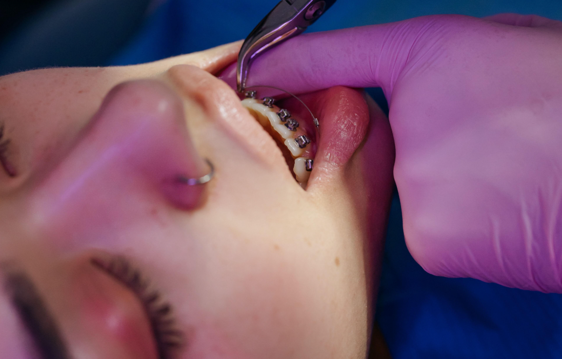 Higiene bucodental